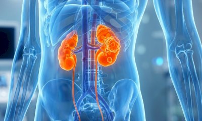 Arriva in Italia la prima terapia sistemica per la sindrome di von Hippel-Lindau